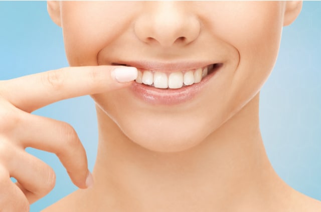 ציפוי חרסינה לשיניים – האם הוא עדיף על ציפויים אחרים?