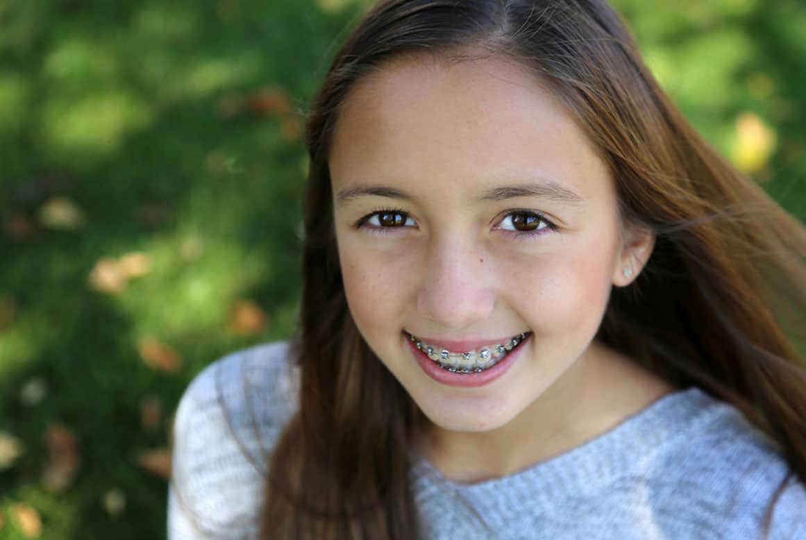 כיצד יכולים בני הנוער לשמור על החיוך הזוהר שלהם?