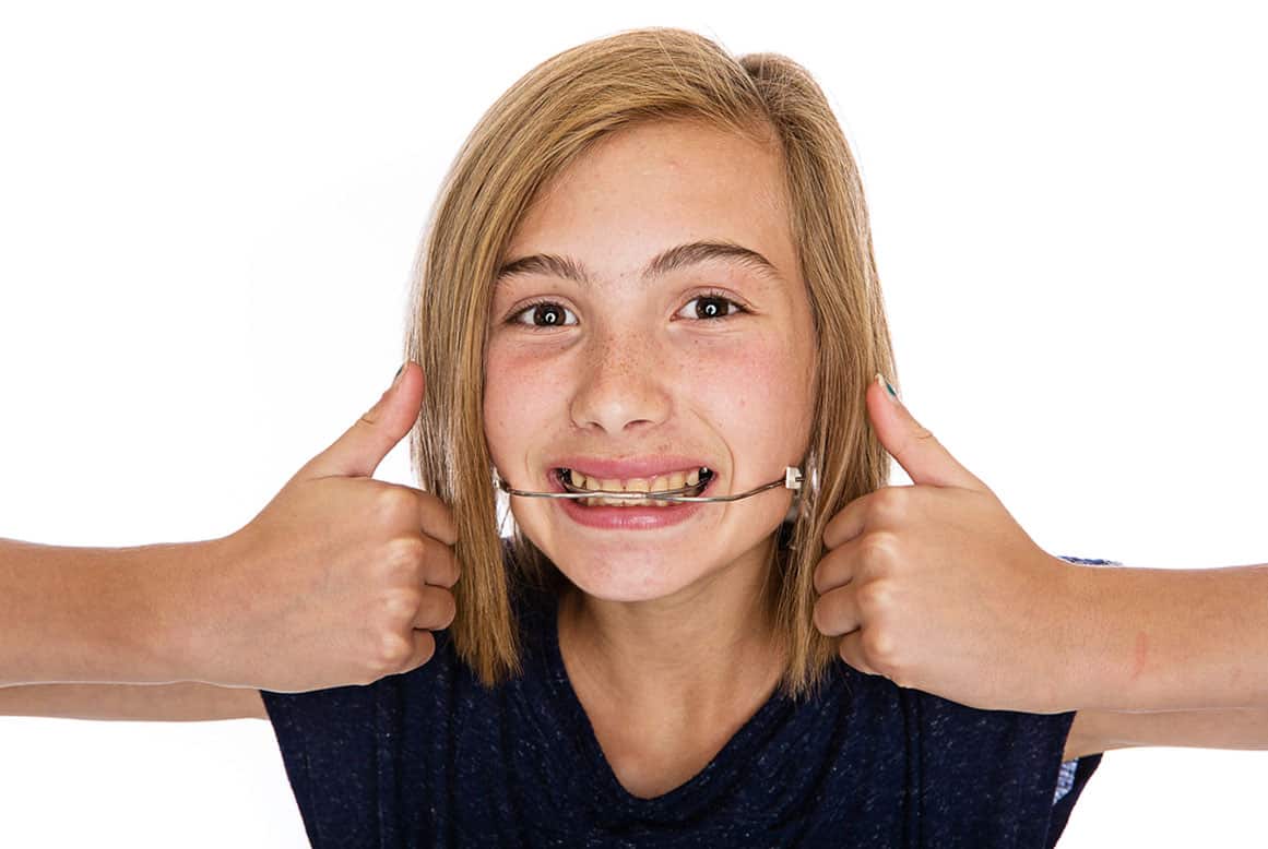 רסן בשיניים – האם זה מתאים לבעיה של הילד שלי?