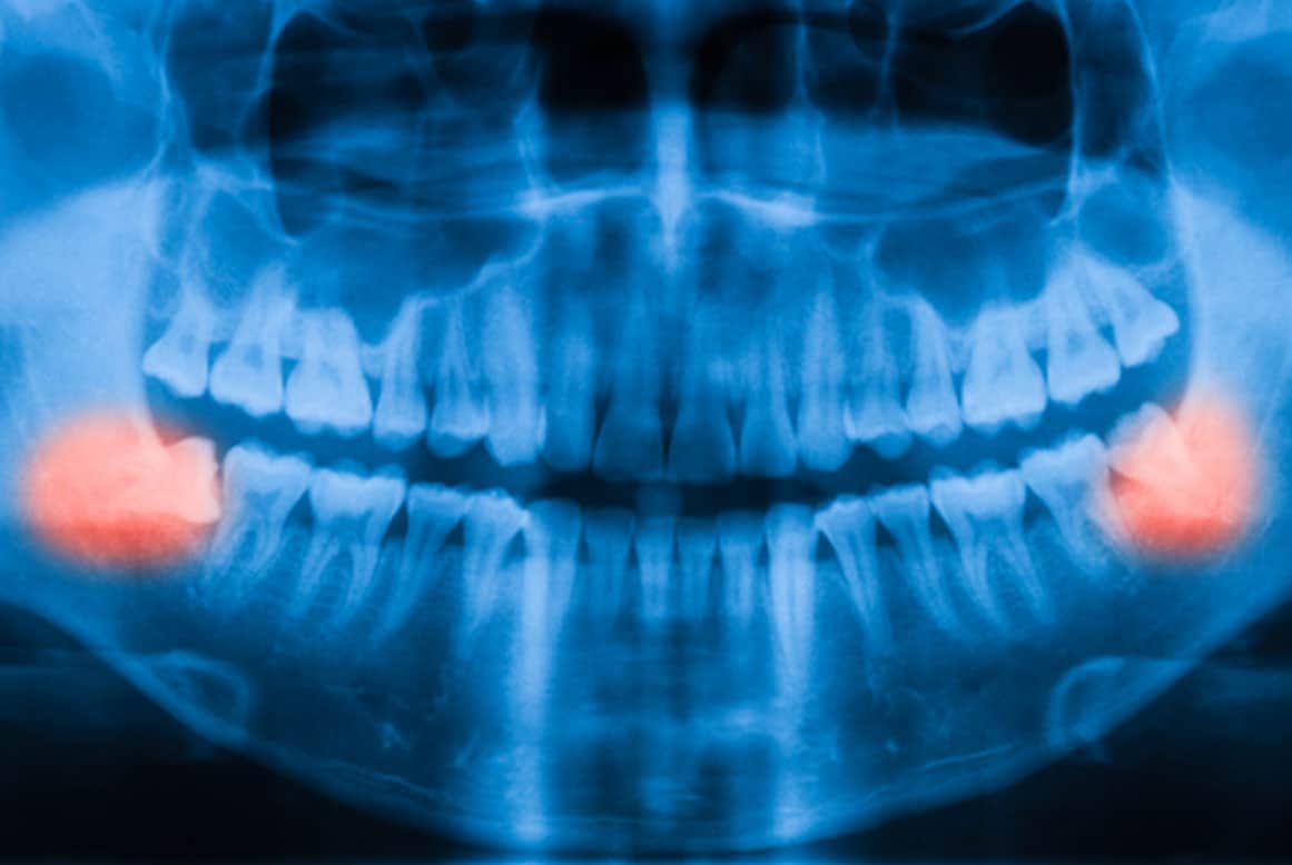 צילומי שיניים – מובילים את השינוי